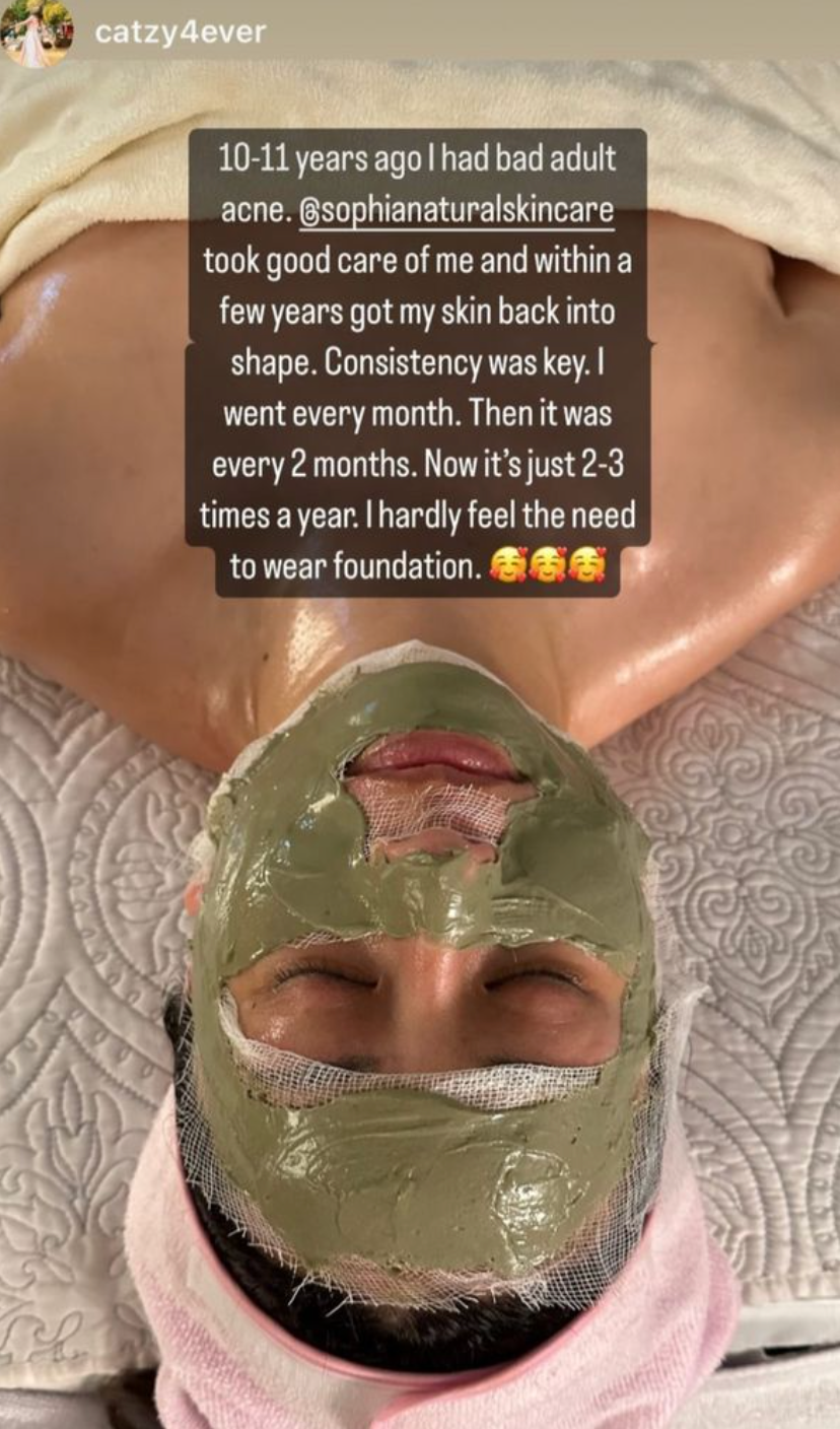 This client experienced an incredible skin transformation after customized organic facials and handcrafted skincare at Sophia Naturals Skincare in Santa Clara, CA. Her skin is now clearer, smoother, and glowing thanks to our holistic treatments and natural products. she has been our client for over 10 years, in her own words she says that she gets facials every 2-3 months and now she doesn't even have to wear foundation.