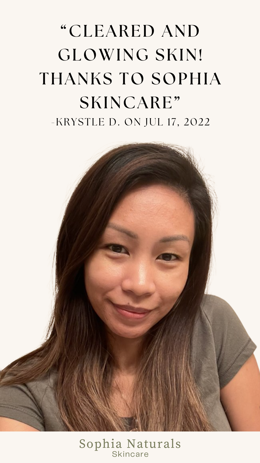 This client experienced an incredible skin transformation after customized organic facials and handcrafted skincare at Sophia Naturals Skincare in Bay Area . Her skin is now clearer, smoother, and glowing thanks to our holistic treatments and natural products. Trusted by clients across the Bay Area for personalized facials and visible results.