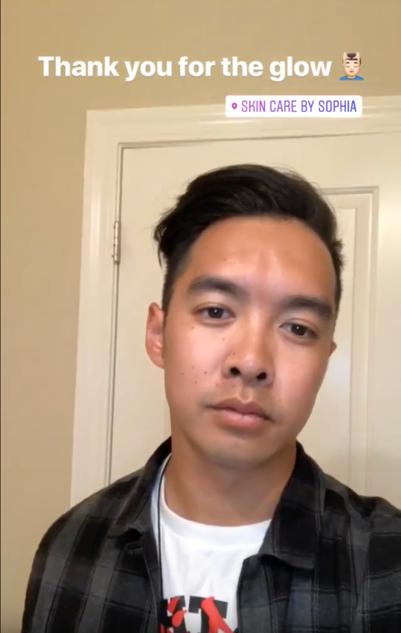 This male client experienced an incredible skin transformation after customized organic facials and handcrafted skincare at Sophia Naturals Skincare in silicon valley . His skin is now clearer, smoother, and glowing thanks to our holistic treatments and natural products. Trusted by clients across the Bay Area for personalized facials and visible results.